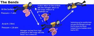 Decompression Sickness, what you need to know about “The Bends”